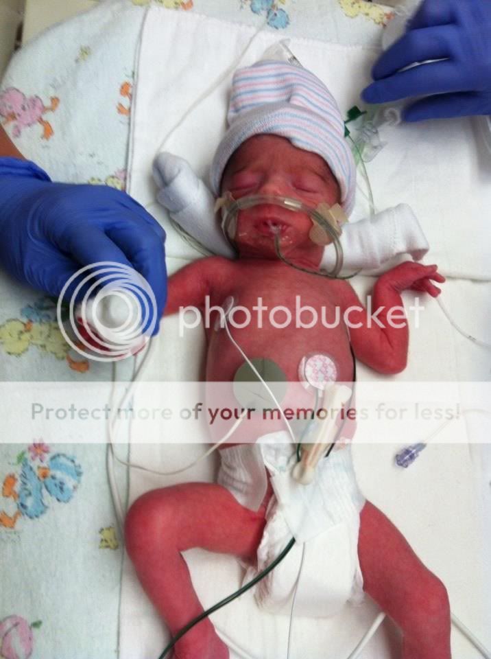 Any babies born at 32 weeks? T&P UPDATE pic BabyCenter